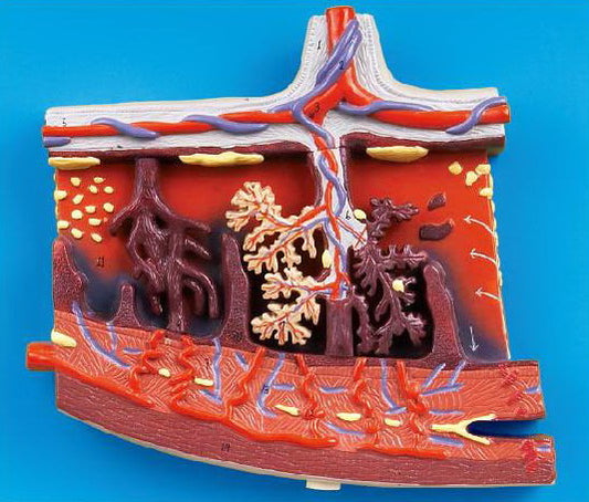 ENLARGED MODEL OF PLACENTA (SOFT)