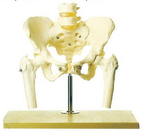 LIFE-SIZE PELVIS WITH 5PCS LUMBER VERTEBRAE MOL225