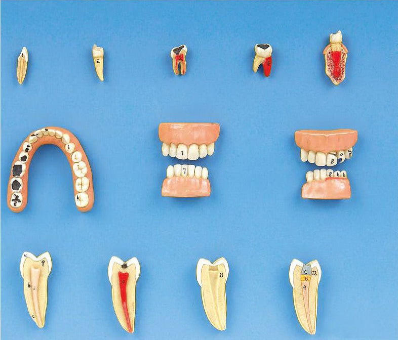 DENTAL DISEASES MODEL