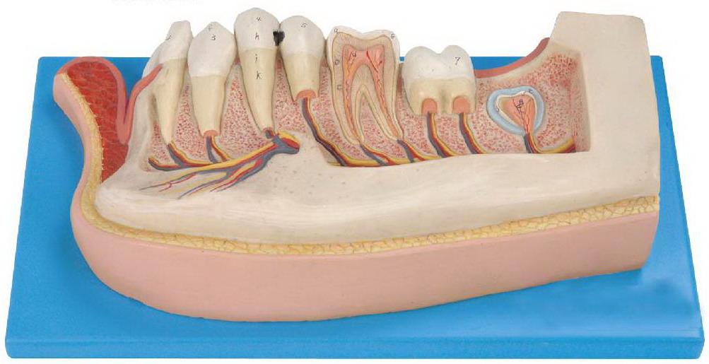LOWER JAW OF 12-YEAR-OLD
