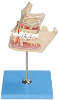 PATHOLOGIC TOOTH WITH JAW