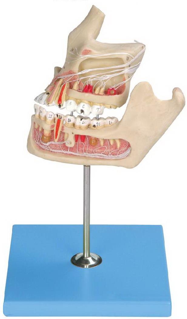 PATHOLOGIC TOOTH WITH JAW