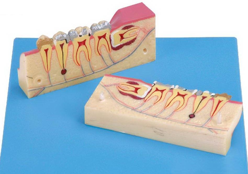 DISSECTED MODEL OF TEETH TISSUE