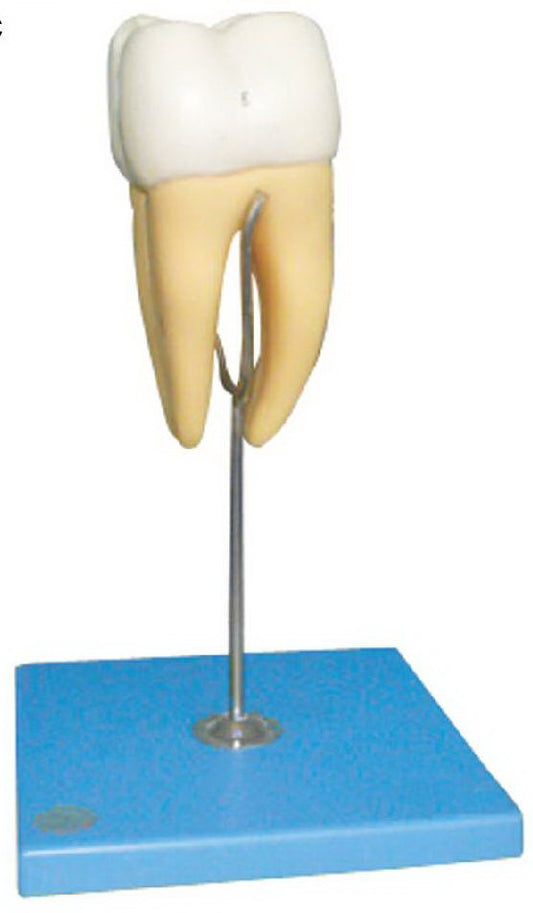 MOLAR MODEL