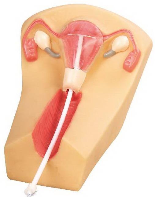 IUD PLACEMENT TRAINING SIMULATOR (SOFT)