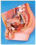 MEDIAN SECTION OF MALE PELVIS (SOFT)